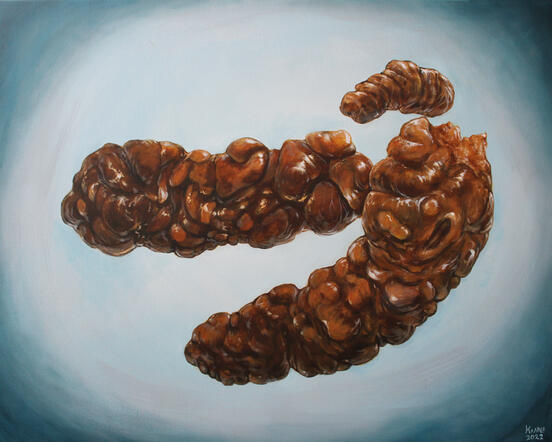 ''Ummetus'', acrylics